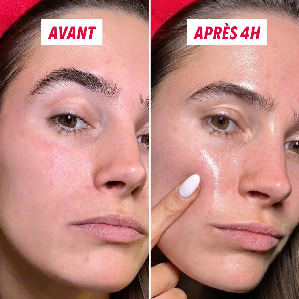 Avant après utilisation masque bio-collagène My SOS Beauty