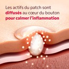 Gros plan sur la texture micropoints du patch My SOS Beauty
