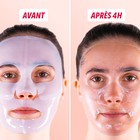 Résultats avant après utilisation du Duo Fermeté visage