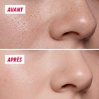 Gros plan de la peau du nez, avant et après