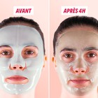 Visage portant le masque à la Centella asiatica, avant et après