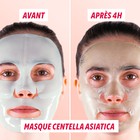 Résultats avant après routine peau parfaite My SOS Beauty