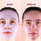Visage portant le masque en gel, avant et après
