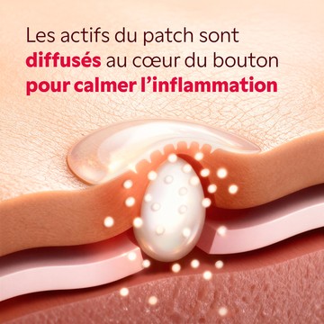 Gros plan sur la texture micropoints du patch My SOS Beauty
