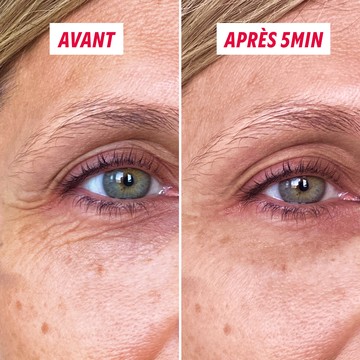 Résultat avant après gel tenseur yeux rides lissées
