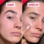 Résultat avant après utilisation masque Centella Asiatica anti-imperfections