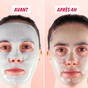 Visage portant le masque à la Centella asiatica, avant et après