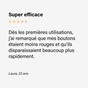 Embout SPOT My SOS Beauty gros plan sur l'électrode en verre