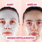 Résultats avant après routine peau parfaite My SOS Beauty
