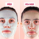 Obličej s maskou s pupečníkem asijským, před a po