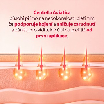 Výsledek po použití CICA masky zklidněná pleť