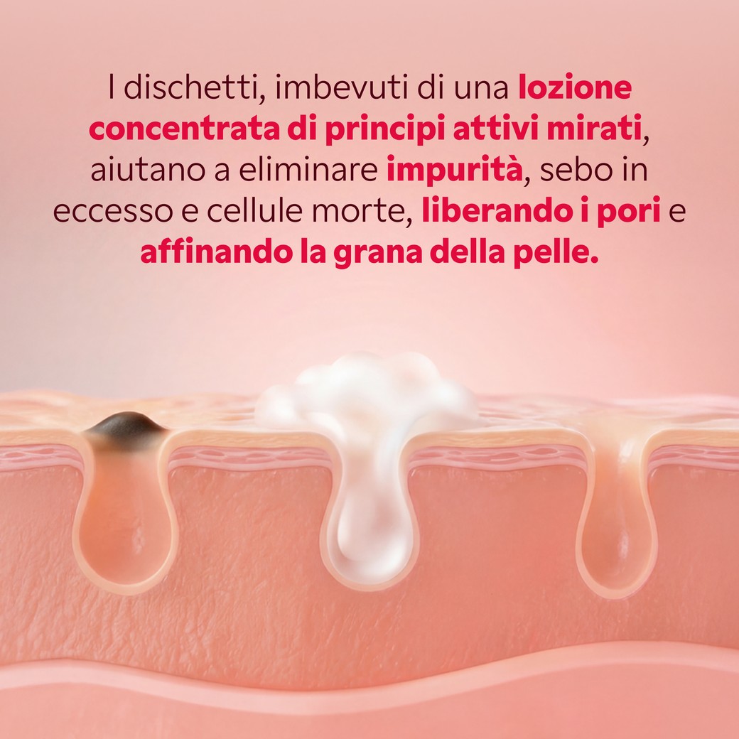 Applicazione pad purificante My SOS Beauty sul viso