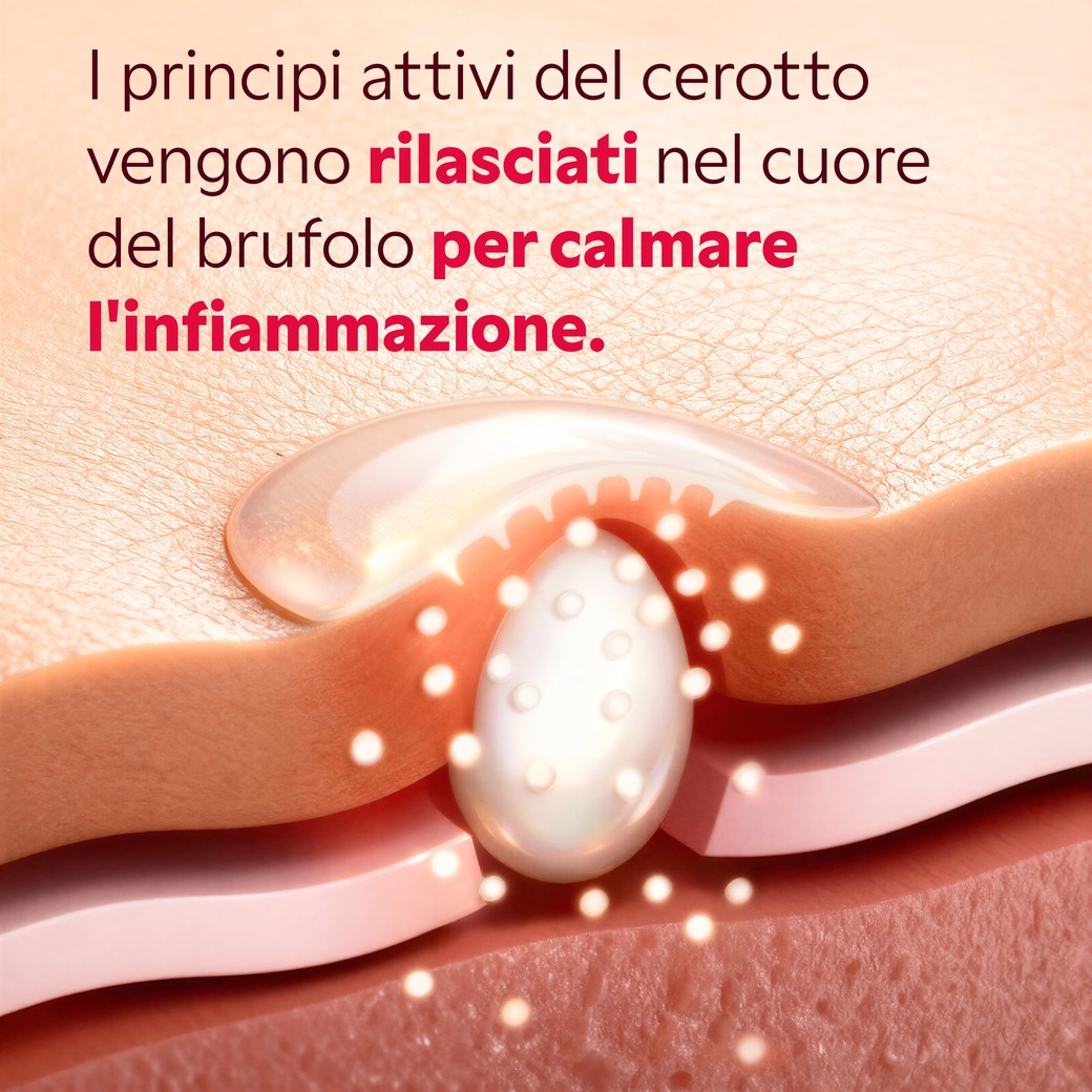 Confezione 9 cerotti micropunti brufoli sottocutanei My SOS Beauty
