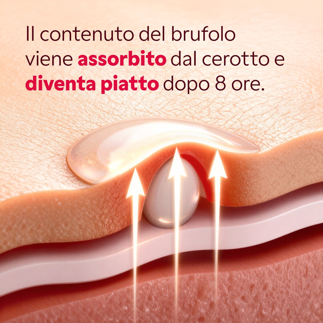 Risultato pelle liscia dopo utilizzo cerotti idrocolloidi My SOS Beauty