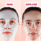 Viso con la maschera alla Centella asiatica, prima e dopo