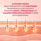 Dettaglio tessuto maschera Centella Asiatica My SOS Beauty monouso