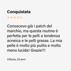 Prima e dopo utilizzo routine anti-imperfezioni completa step 4