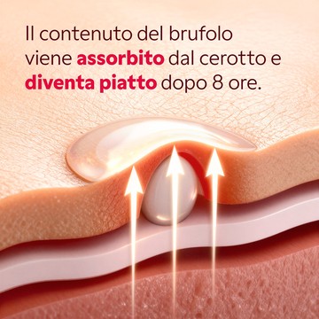 Risultato pelle liscia dopo utilizzo cerotti idrocolloidi My SOS Beauty