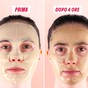 Maschera monouso Vitamina C My SOS Beauty applicata sul viso