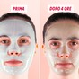 Viso con la maschera alla Centella asiatica, prima e dopo
