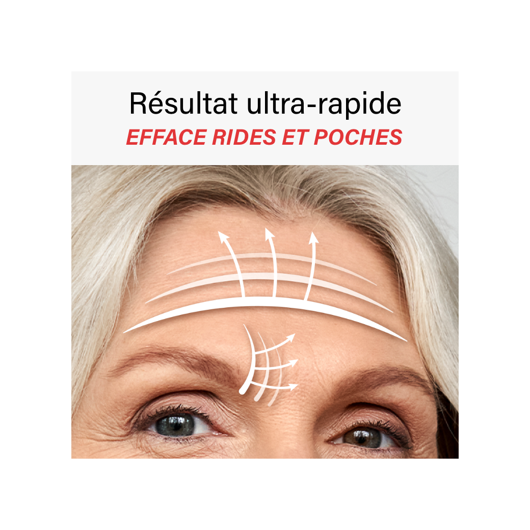 Illustration zum Auftragen des Gels auf die Stirn
