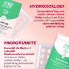 SOS Pickel Patches Kit Anwendung auf verschiedenen Pickelarten