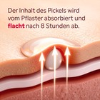 Hydrokolloid Pflaster auf der Haut aufgeklebt Anwendung