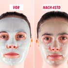 Gesicht mit der Centella-asiatica-Maske, vorher und nachher
