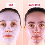 Gesicht mit Gelmaske, vorher und nachher