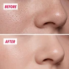 Close-up of the skin on the nose, before and after