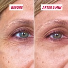 Instant Lift Gel and Bakuchiol Anti-Aging Serum duo front view