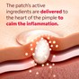 Salicylic acid microdot patch magnified active ingredients view