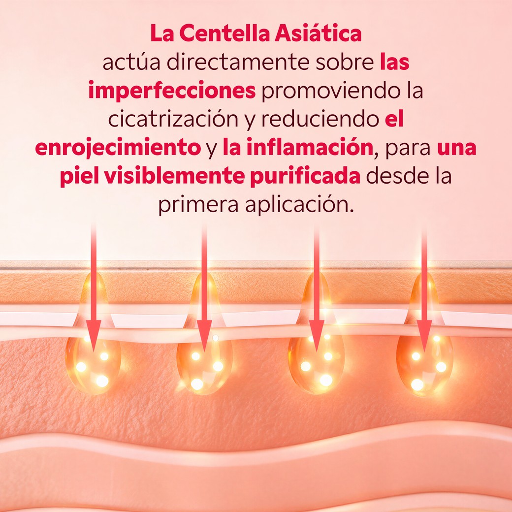 Resultado piel purificada tras mascarilla Centella Asiática My SOS Beauty