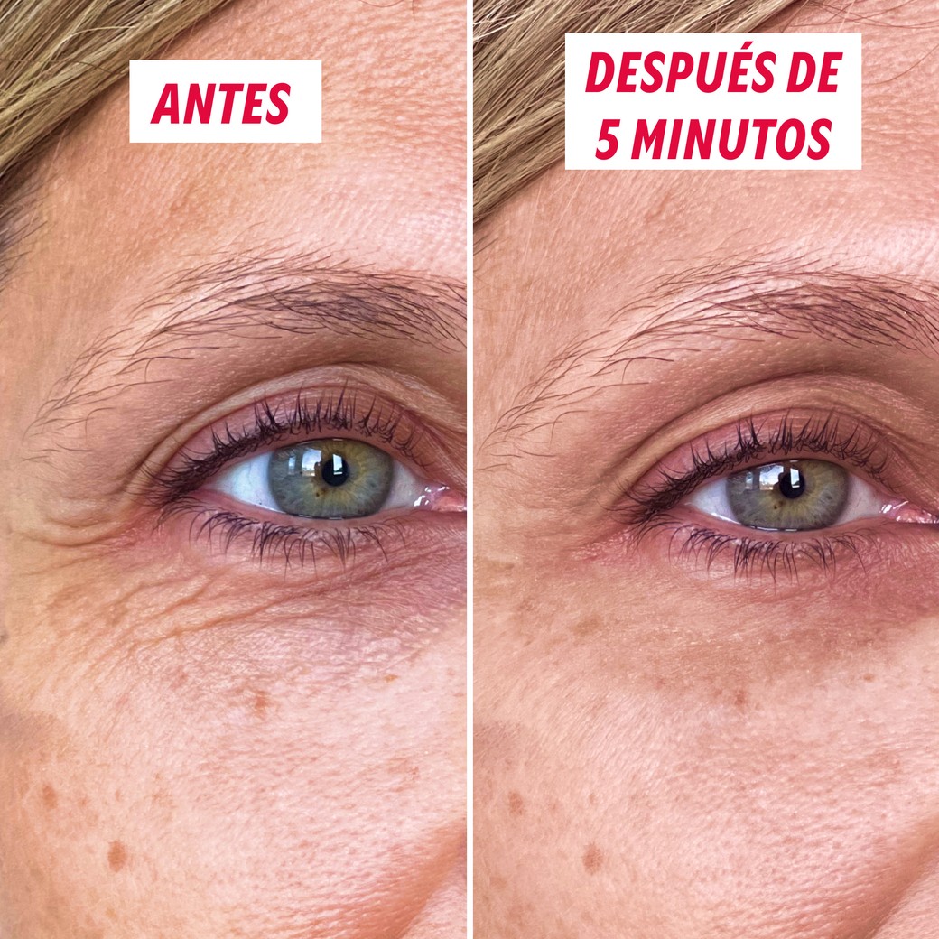 Resultado antes y después del gel tensor ojos My SOS Beauty