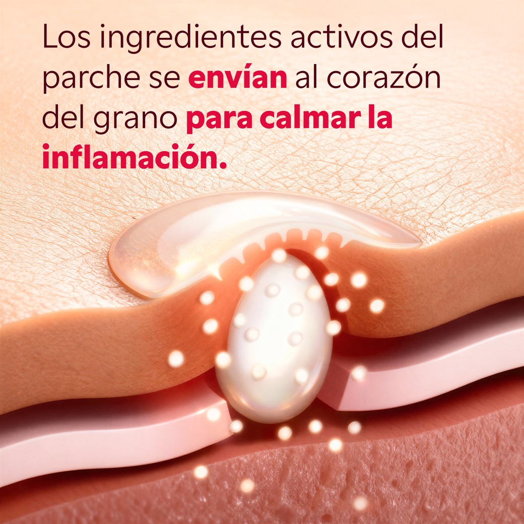 Caja de 9 parches micropuntos My SOS Beauty