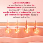 Resultado piel purificada tras mascarilla Centella Asiática My SOS Beauty