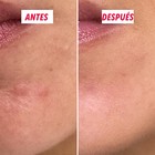 Textura cremosa del soin actif imperfections My SOS Beauty