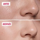 Primer plano de la piel de la nariz, antes y después