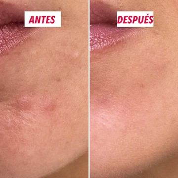 Textura cremosa del soin actif imperfections My SOS Beauty