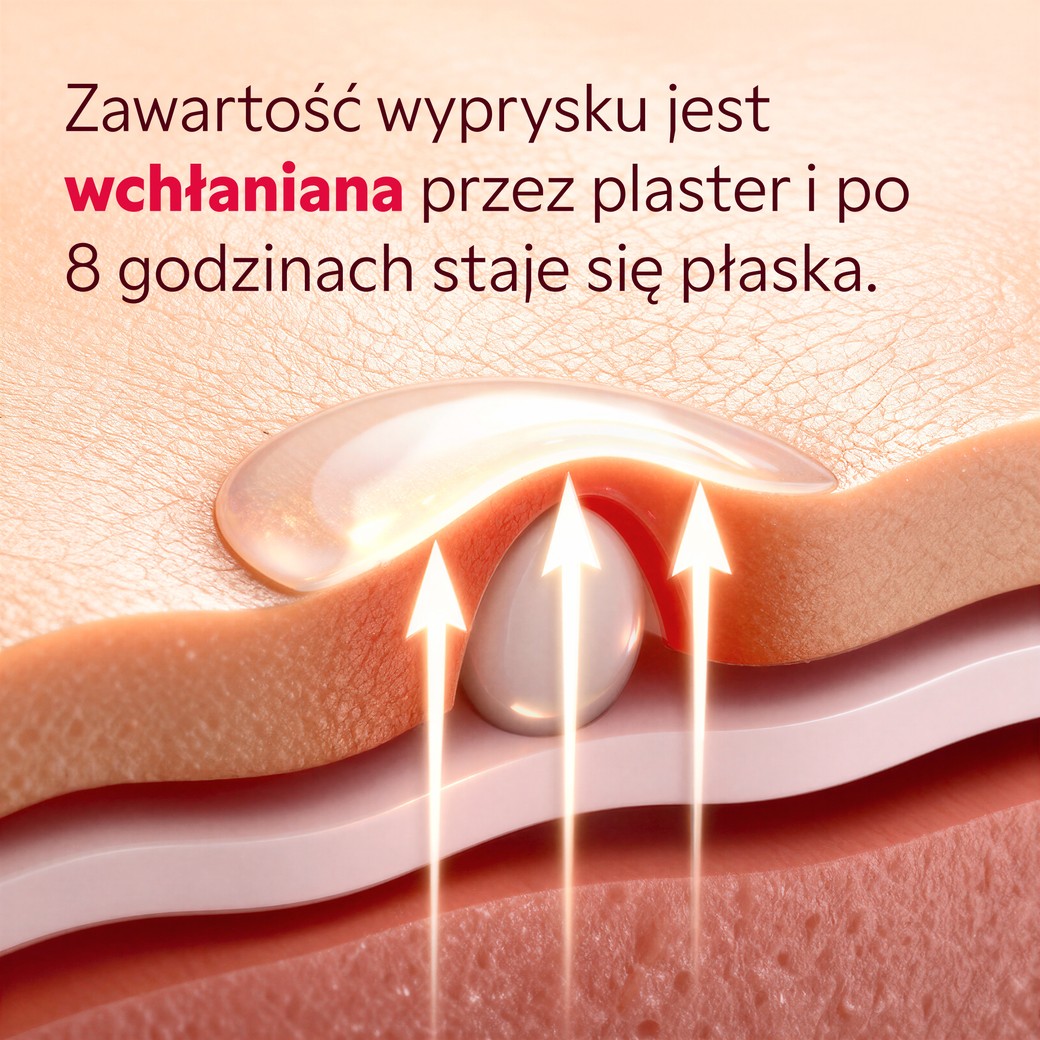 Hydrokoloidní náplast SOS Patchs absorbující nečistoty z pupínku