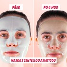 Obličej s maskou s pupečníkem asijským, před a po
