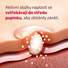 SOS mikrobodová náplast před a po použití na pupínek