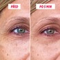 Nanášení gelu SOS Tensyeux na vrásky a váčky pod očima
